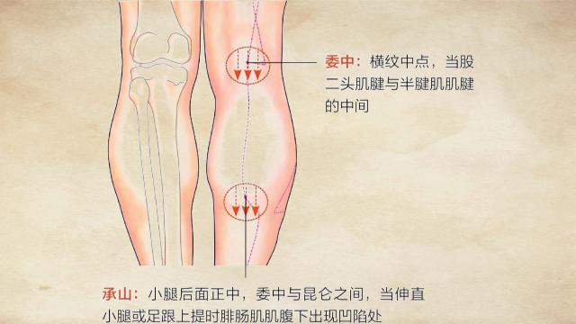 坐骨神经痛针灸哪个穴位止痛最快,坐骨神经痛三个穴位搞定