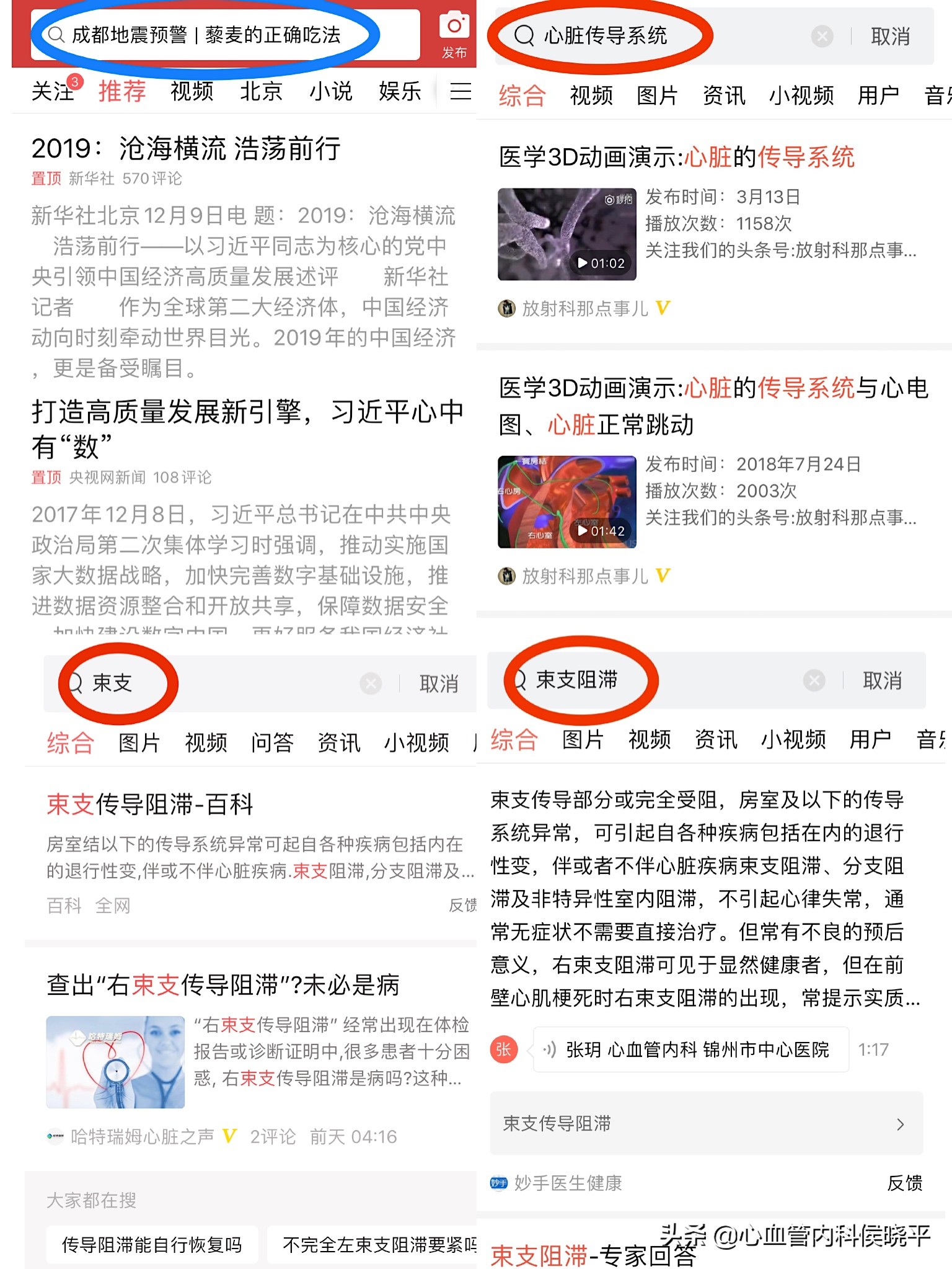 心电图看出什么堵塞,心电图查出右束支阻滞