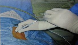 山东治疗泌尿外科比较好的医院,山东大学附属医院泌尿外科专家