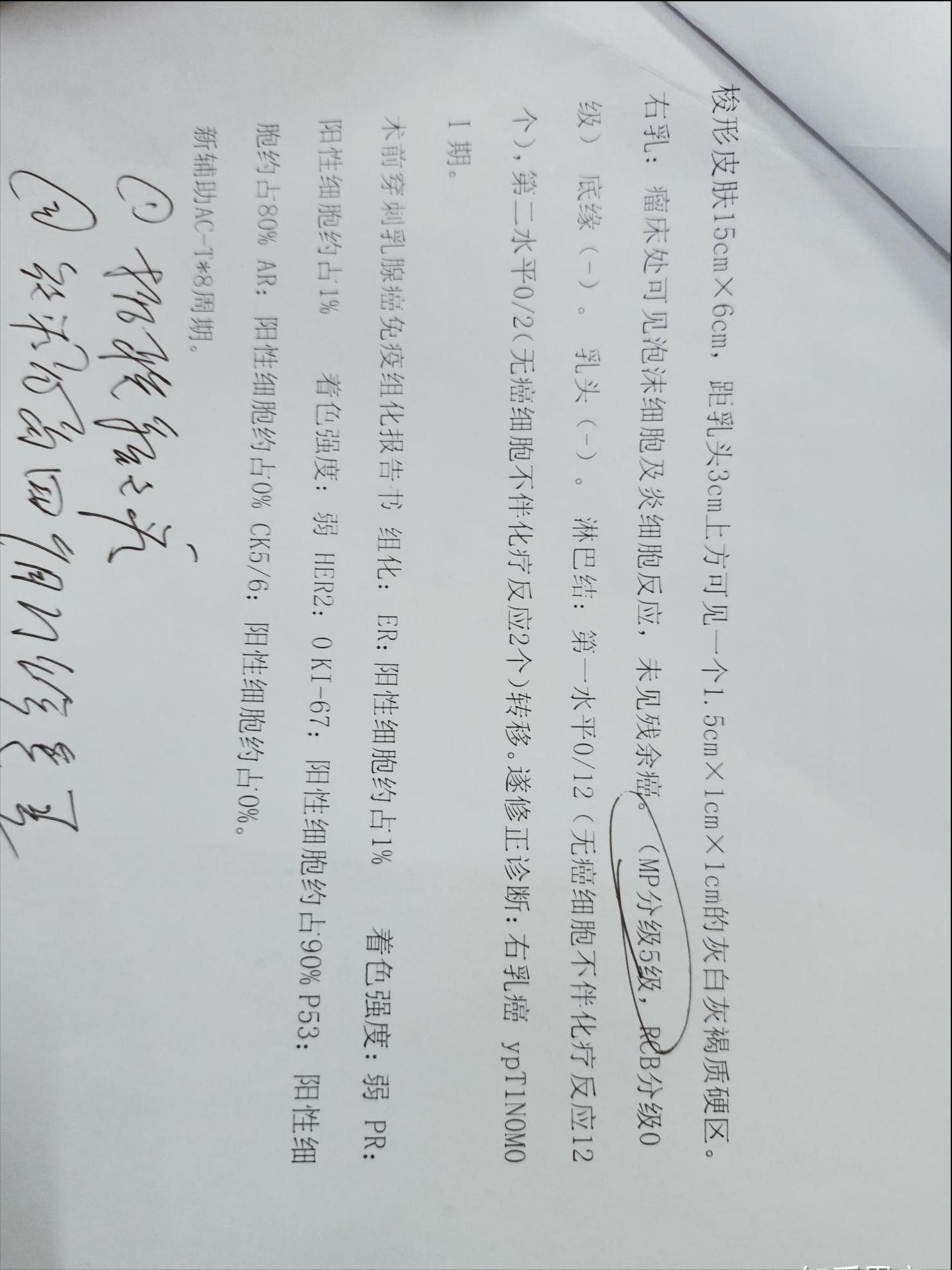 晚期三阴乳腺癌的治疗方案,三阴浸润性乳腺癌100%的复发吗