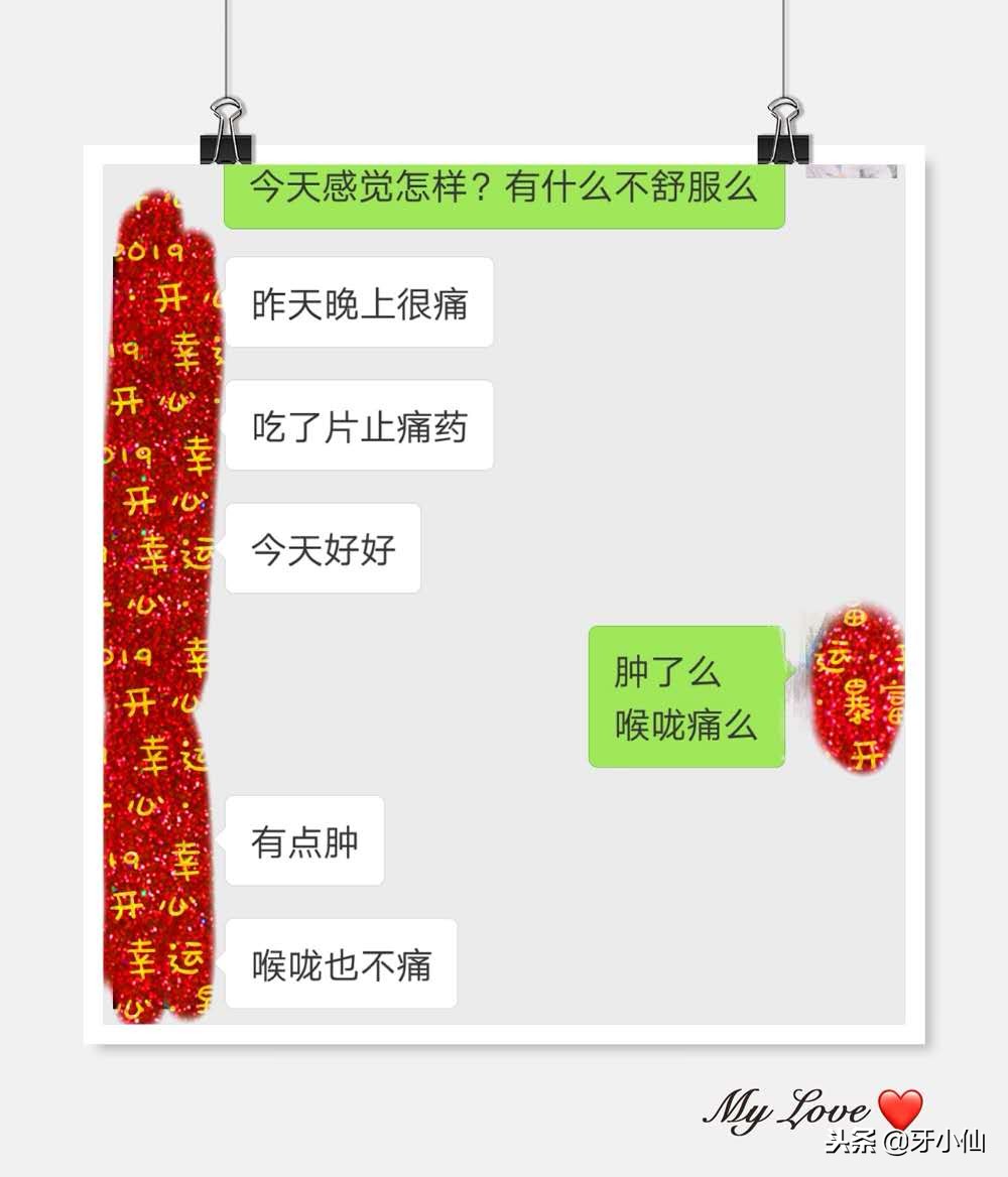 拔牙疼不过三秒,亲身经历告诉你拔牙到底痛不痛