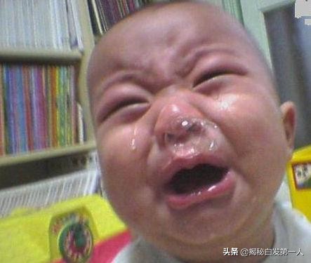 为什么会流清鼻涕,为什么会流清鼻涕和眼泪