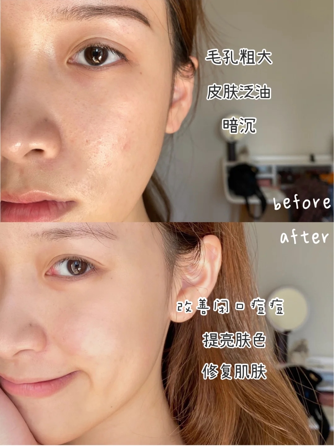 三十岁用的抗皱眼霜,三十加淡纹抗皱眼霜