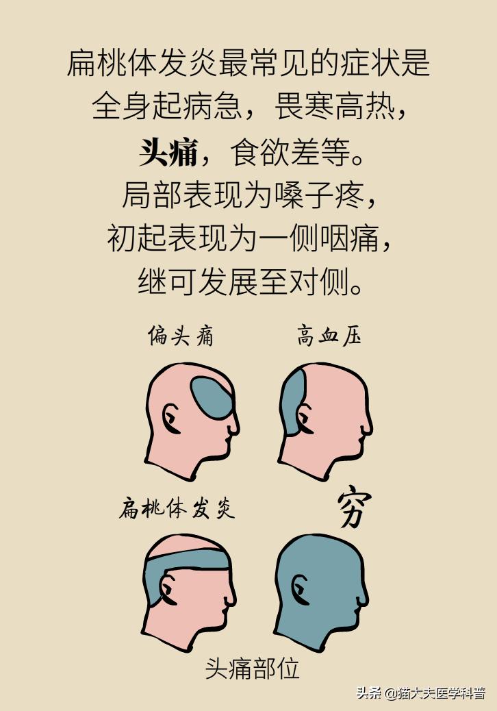 扁桃体肿大一侧和两侧区别,单侧扁桃体肿大患癌的几率是多少