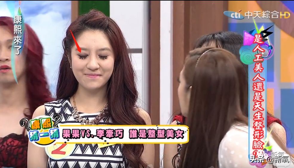 花90万从头整到脚，还可以这么自然？旁边纯天然小姐姐都看懵了