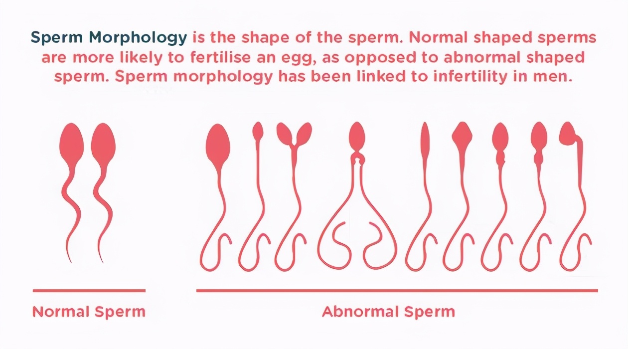 研究显示：精子像钻头一样钻入体内！它“欺骗”了科学家300多年