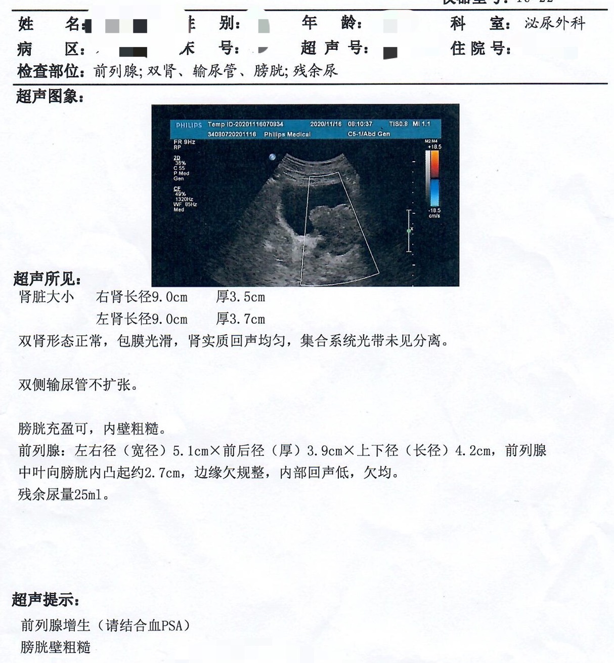 泌尿外科60秒教你看懂血常规,泌尿系统彩超包括哪些部位