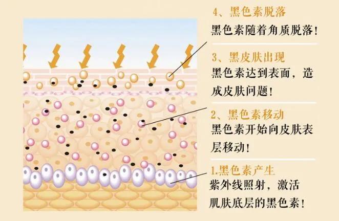 褐青色斑治疗最佳时间,褐青斑有哪些症状