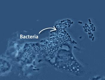 内裤泛黄发硬是有炎症吗,裤头上老有黄黄的结块怎么办