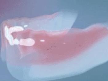 如何预防宝宝的双排牙,换牙出现双排牙不齐怎么办