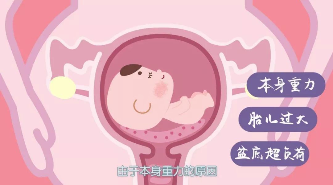 盆底健康知识讲座大全,关爱女性盆底健康课程