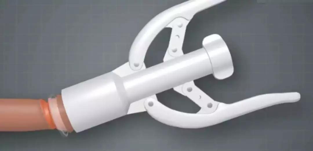 传统手工切包皮,包皮手术手工切割好还是机器好