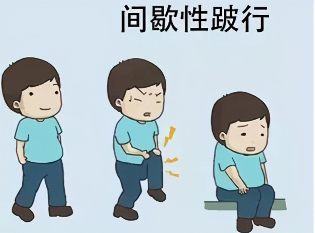 颈椎椎管狭窄手术成功率,2020年胸椎管狭窄手术成功率