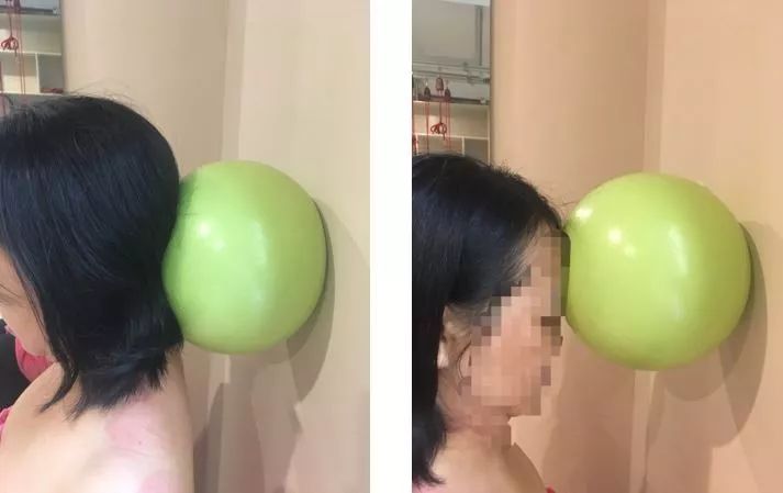 颈椎脖子咔咔的响是什么原因,脖子咔咔响经常落枕