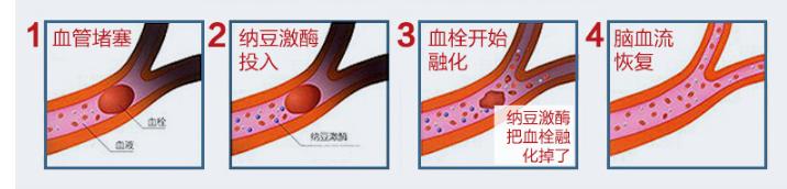 isdg纳豆激酶在日本有名吗,日本最好的纳豆激酶