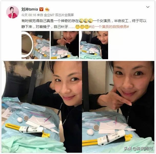 良医|明星们都在做烤瓷牙？但你最好别跟风