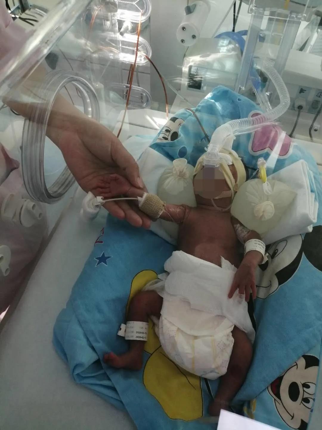 孕33周胎膜早破早产胎儿的成活率,胎儿足月不到预产期胎膜早破