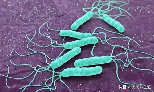 内裤上好多脏东西怎么回事,女性裤子有很大异味怎么回事