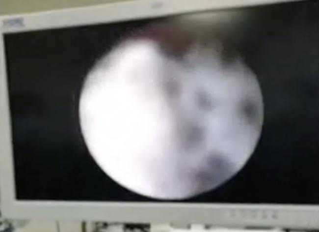 妈妈发现女儿身上有血迹,母亲发现女儿身上散发臭味