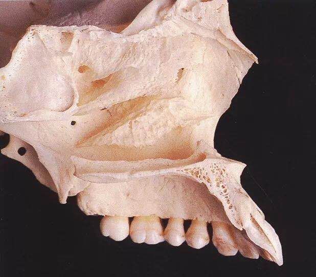 咬合重建的程序,咬合重建做嵌体