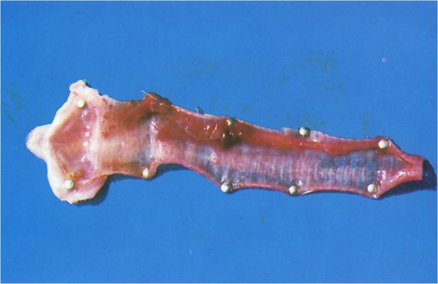 鸡传染性喉气管炎如何防治,鸡传染性喉气管炎疫苗大鸡用量