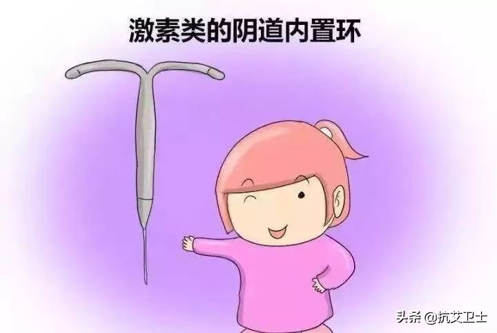 如果阴道环可以防艾滋，你会使用吗？