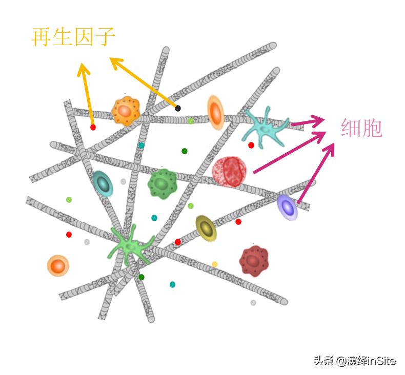 脊髓损伤将不再是不治之症,脊髓损伤手不能动能治愈吗