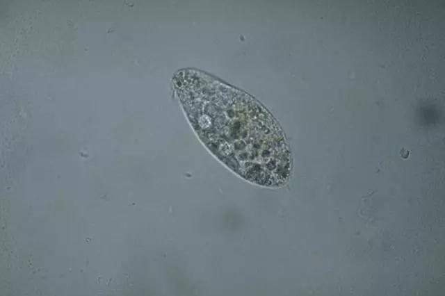 收藏!24种污水处理微生物菌相及指导意义,环保人必看(多图)