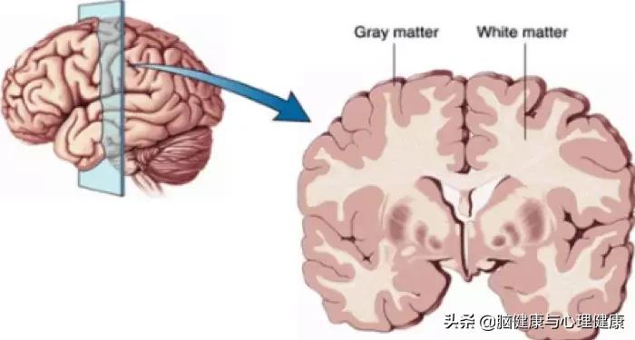 运动可以提高卵磷脂小体吗,足球运动可以促进孩子大脑发育吗