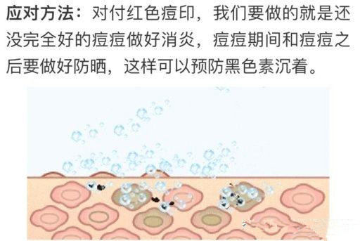 一脸痘痘也要自信满满,一脸痘痘多害怕