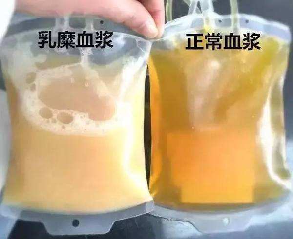 谁能让检验科医生闻风丧胆？