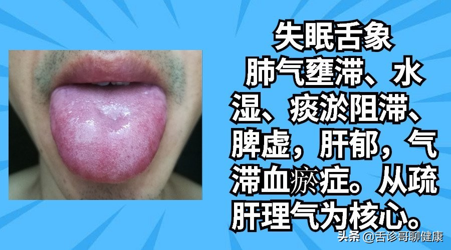 各种舌象分析病情,舌诊哥是如何治疗病人的