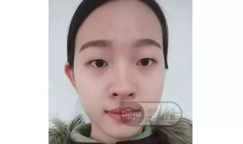 中庭短显年轻还是显老,中庭长怎么避免显老