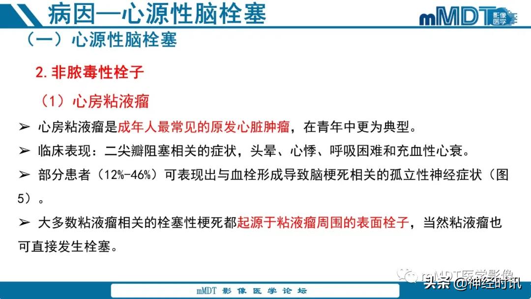 急性缺血性脑卒中ppt素材图片,青年缺血性脑卒中ppt