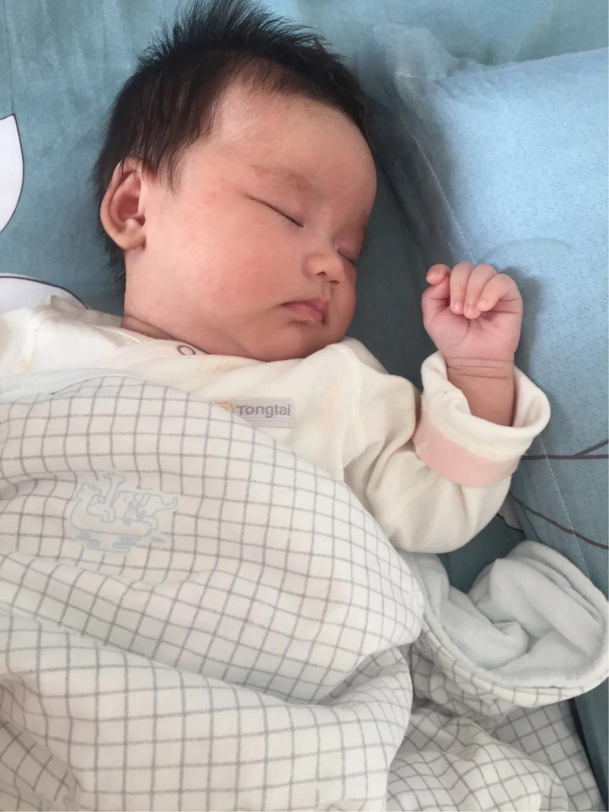 宝宝得湿疹妈妈怎么忌口,宝宝湿疹怎么办宝妈分享