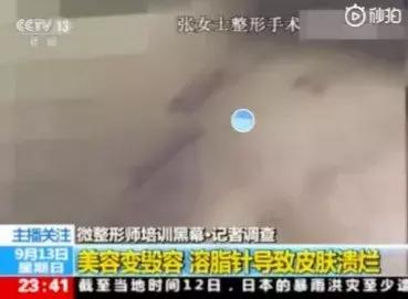 5天上岗,年入百万:微整形,正在毁掉无数中国女人