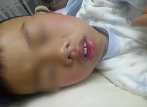 儿子长成“大嘴猴”,妈妈带去做检查,医生的话让她无地自容