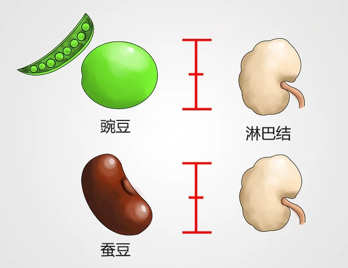人体的淋巴结怎么检查,淋巴结肿大最好的检查方法