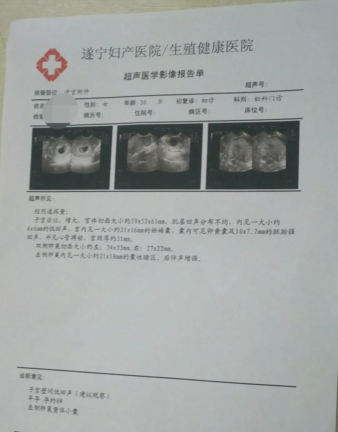 采访主持人方琼视频,方琼不为人知的故事