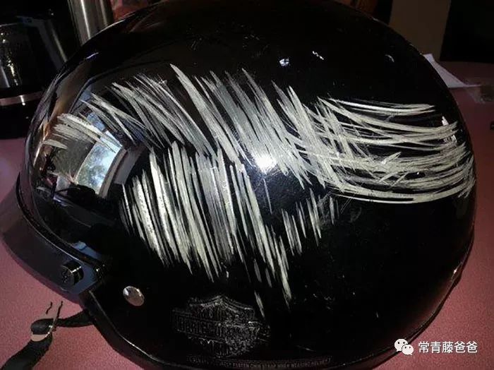 小朋友在美国险些脑袋开花，全靠麻省这条法律捡回一条命