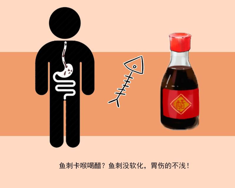 鱼刺卡喉吞饭怎么处理,鱼刺卡喉后喝醋吞饭团