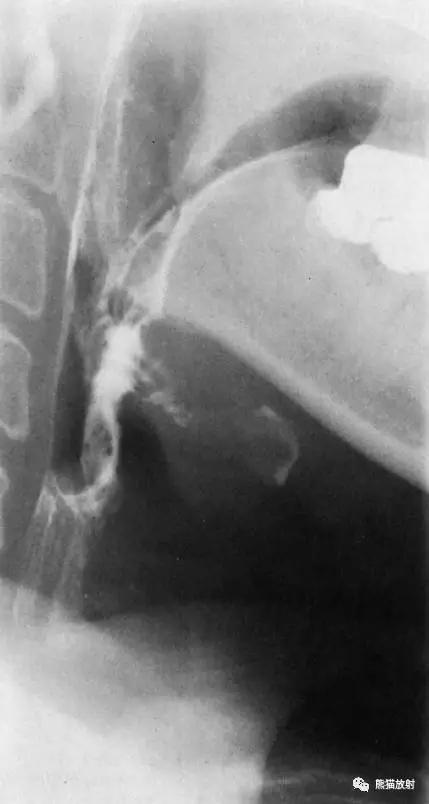 详细的消化道造影+彩色解剖图