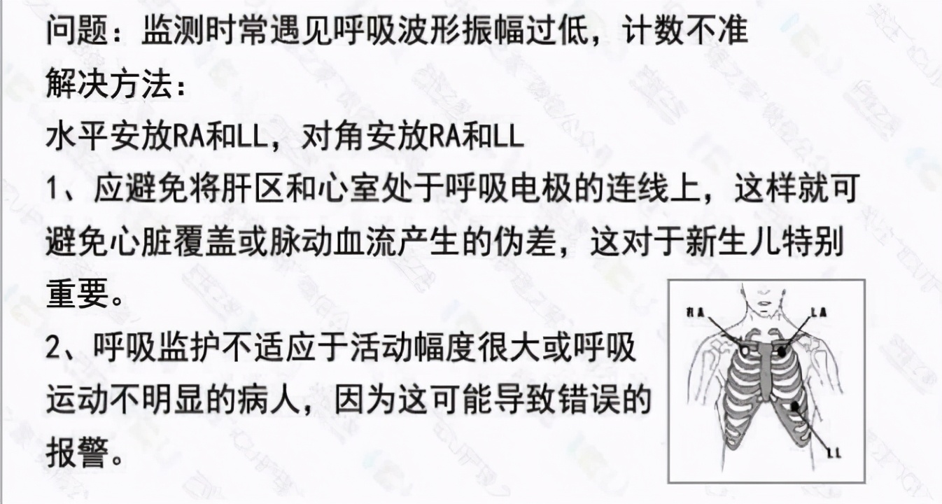 心电监护使用ppt,心电监护使用时间计算