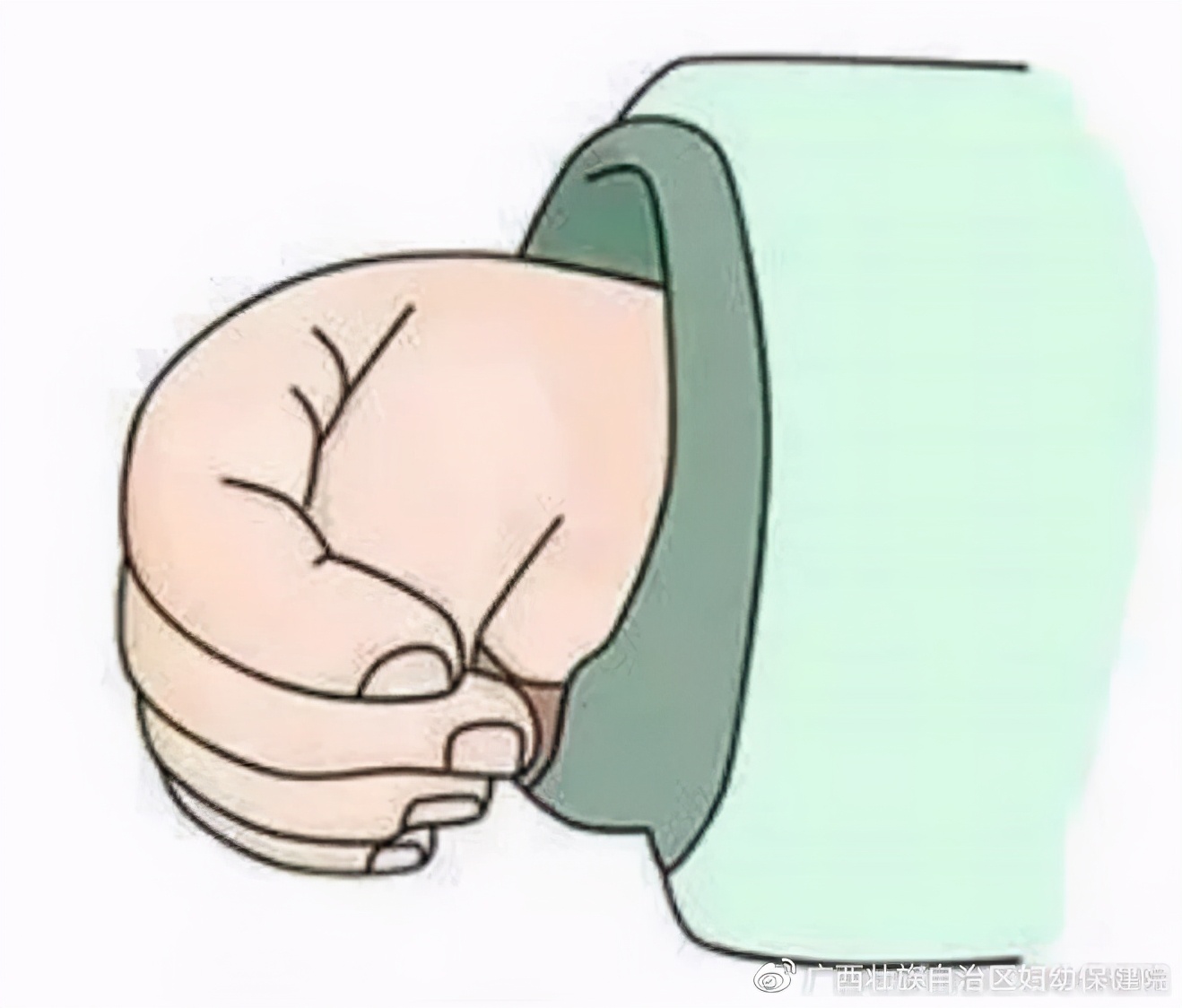 宝宝大拇指一直内扣怎么纠正过来,宝宝拇指内扣最严重的结果是什么