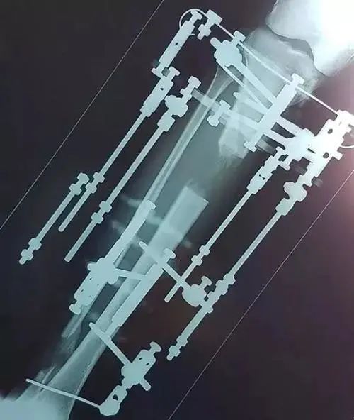 私密整容紧缩手术在中国合法吗,整容医院做私密收紧术要住院吗