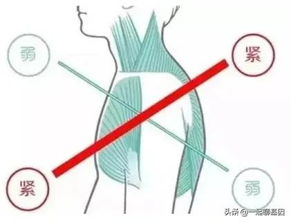 驼背如何矫正最快最有效方法,驼背怎么办最有效的方法