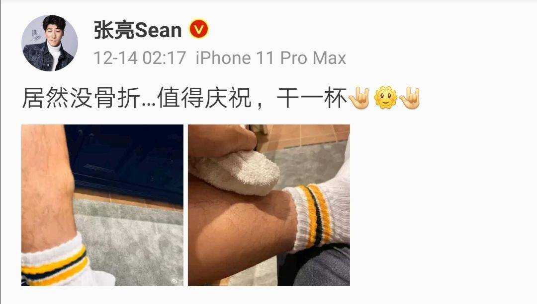 张亮受伤,张亮忠脚崴