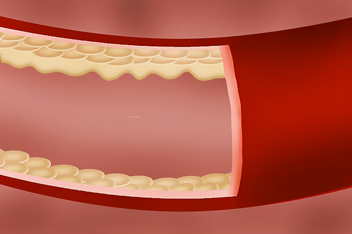 血压高少量喝点酒可以吗,血压高的人可以喝点酒吗