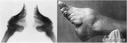 历史上那些审美陋习,古代病态审美束腰裹脚