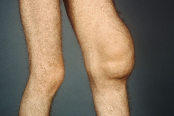 氨糖去哪买才放心,膝盖疼买氨糖怎么选